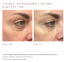 Visual Improvement of using Emepelle Eyecream after 4 weeks
