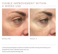 Visual Improvement of using Emepelle Eyecream after 4 weeks